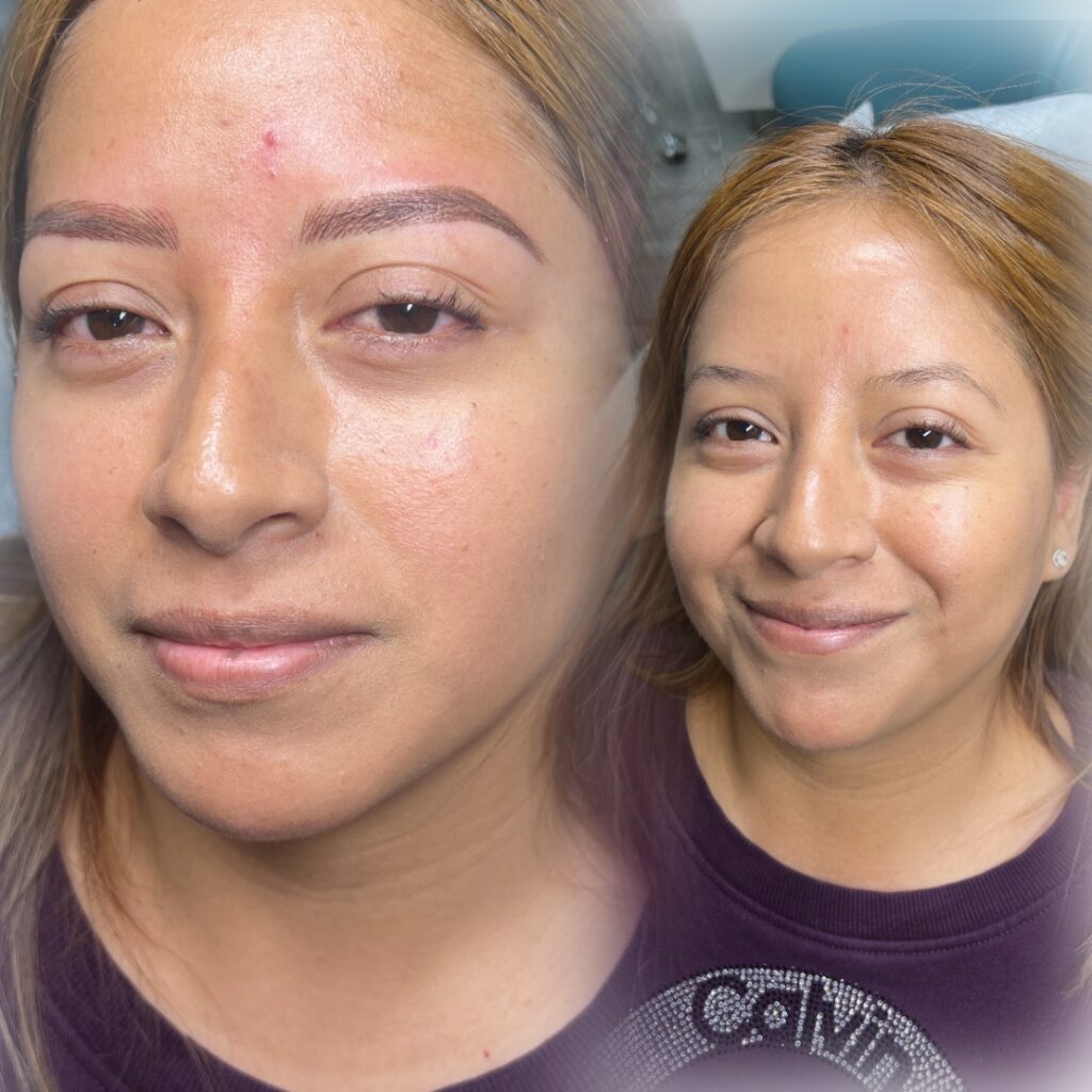 Before and after photo of olive skinned woman who received a nano Combination Brows with Shari Saint
