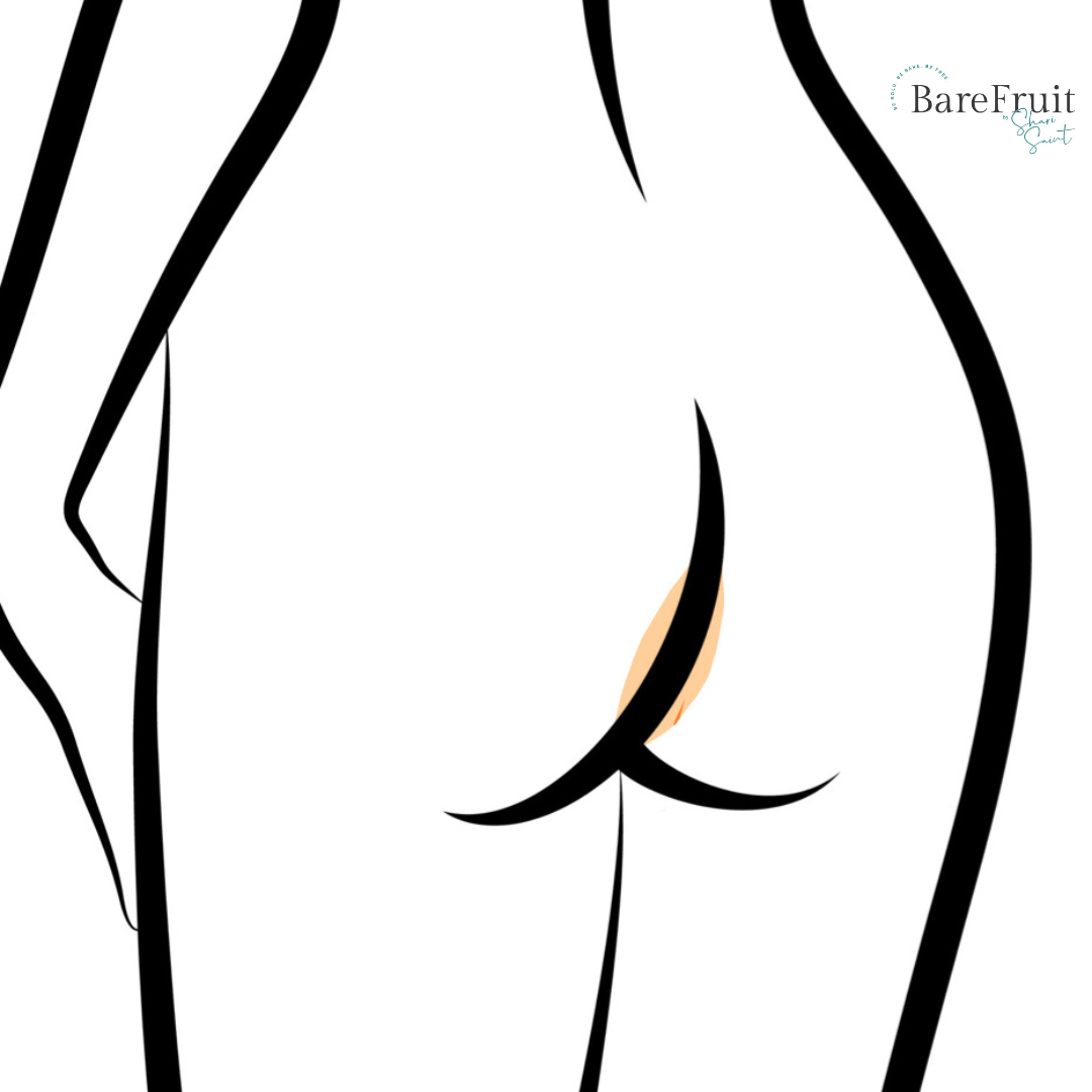 laser hair removal area illustrations bare fruit sugaring -  thong line