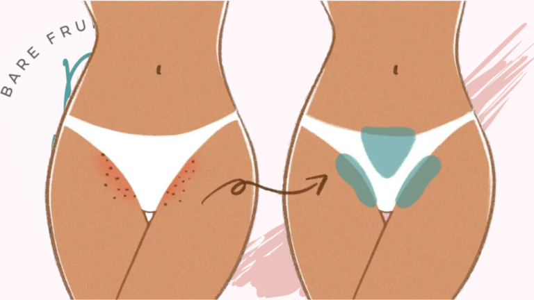 Vajacial Cartoon with ingrowns on bikini line on the left and on the right treated area does cleared up with Bare Fruit Logo in background